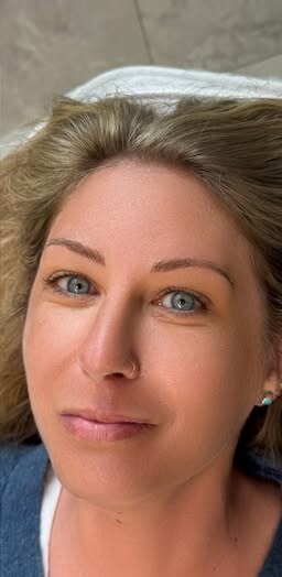 Nano combo brows, healed result